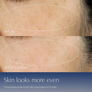 Estée Lauder  Advanced Night Repair Synchronized Multi-Recovery Complex Serum with Hyaluronic Acid