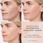 Fenty Beauty by Rihanna  Watch Ya Tone 5% Niacinamide Dark Spot Serum with Vitamin C