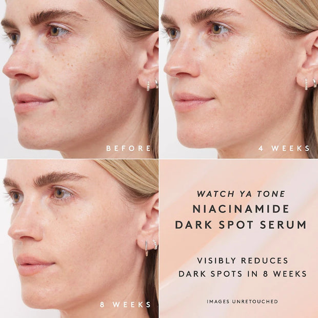 Fenty Beauty by Rihanna  Watch Ya Tone 5% Niacinamide Dark Spot Serum with Vitamin C